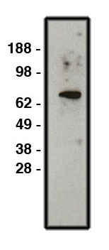 "
Western blot using NHE1 antibody (Cat. No. X2315P) on HT-29 cell lysate.  Lysate used at 30 µg/ml.  Antibody used at 1:400 dilution.  Secondary antibody, mouse anti-rabbit HRP (Cat. No. X1207M), used at 1:50k dilution."